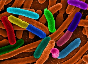 Diverse E.coli